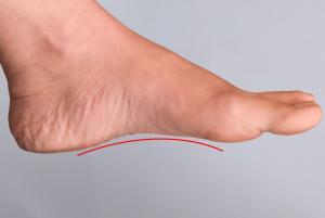 Side view of a woman’s foot