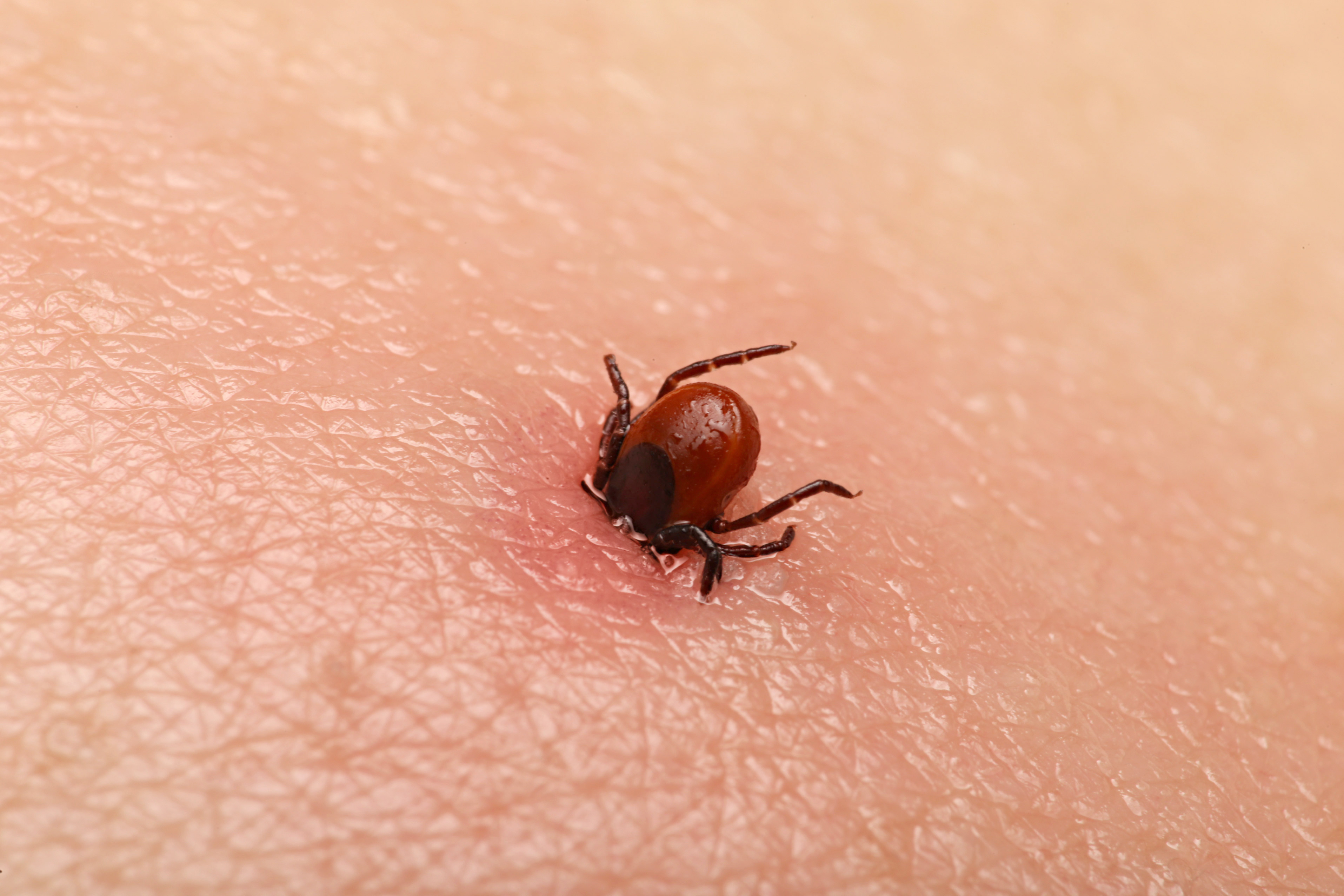 Protect Yourself Against Tick Bites Nidirect Protect Yourself Against Tick Bites Nidirect