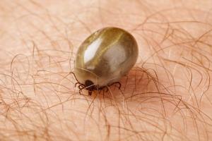 Swollen tick feeding on human skin Swollen tick feeding on human skin