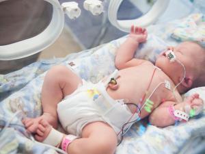 A newborn baby in an incubator A newborn baby in an incubator