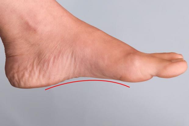 Side view of a woman’s foot